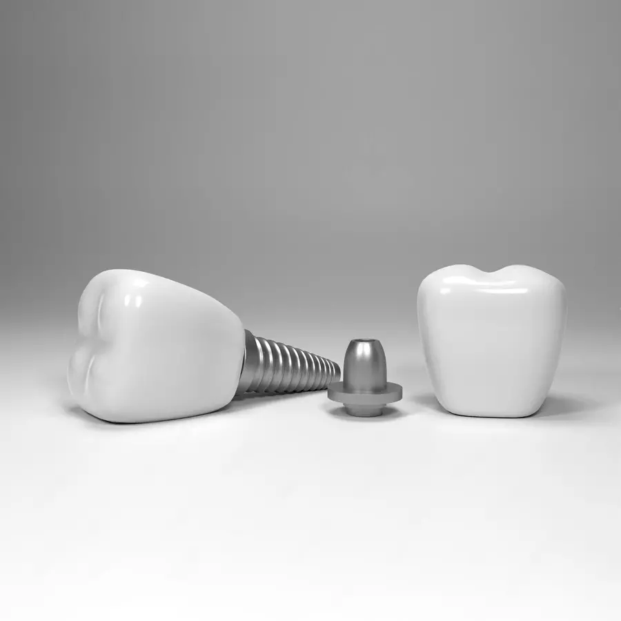 Акция на установку имплантов Straumann всего за <span>55 000₽</span>! Акция на установку имплантов Straumann всего за <span>55 000₽</span>!